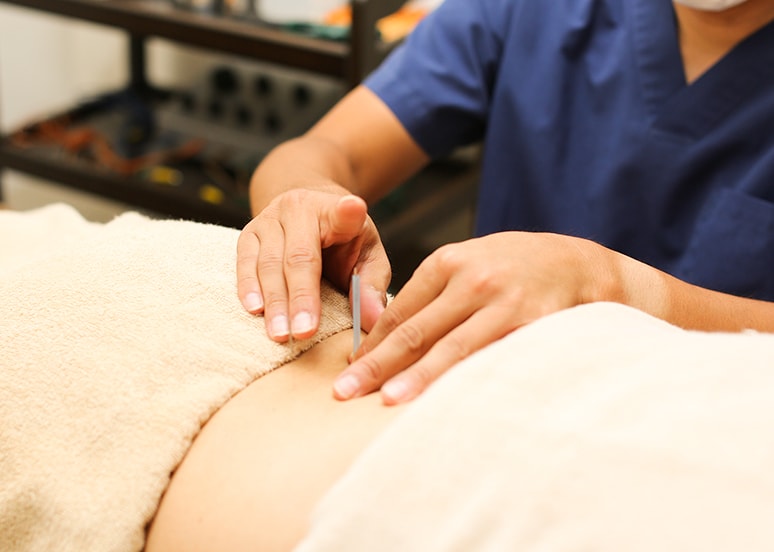 鍼・灸治療